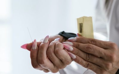 Manfaat dari Terapi Akupuntur yang Harus Anda Ketahui